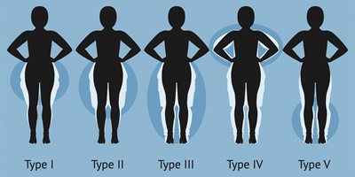 Lipoedeem is een ziekte en geen eetstoornis