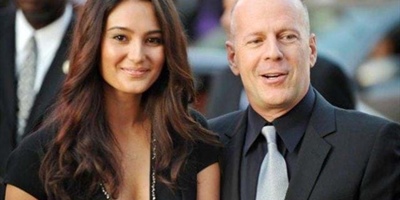 Wat is de ideale leeftijd voor een rimpel injectie-behandeling?